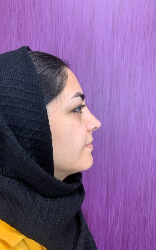 راحله-قاسمی (2)-min