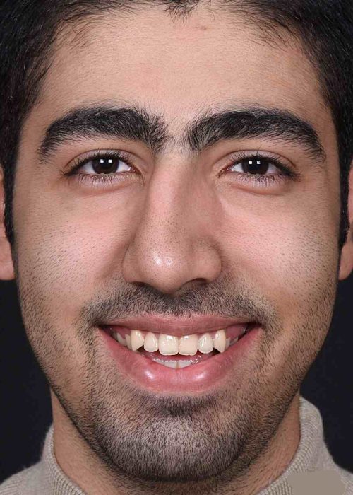 مهدی کریمی (10)