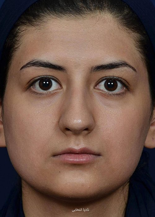 نادیا انتخابی (1)